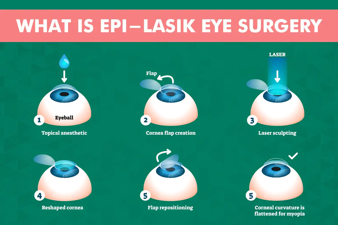 Epi Lasik Surgery Cost India
